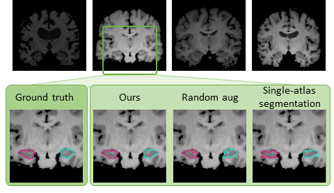 Data Augmentation teaser
